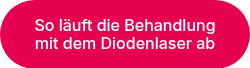 So läuft die Behandlung mit dem Diodenlaser ab