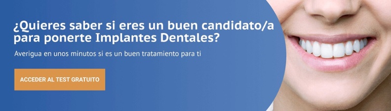 ¿Quieres saber si eres un buen candidato/a para ponerte Implantes Dentales? - Test gratuito