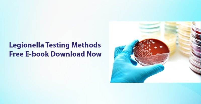 Legionella Testing Methods 